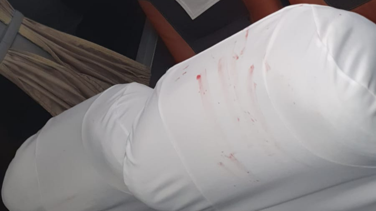Ônibus do Bahia é atingido por bomba na Fonte Nova antes de jogo na Copa do Nordeste; Danilo Fernandes sai ferido