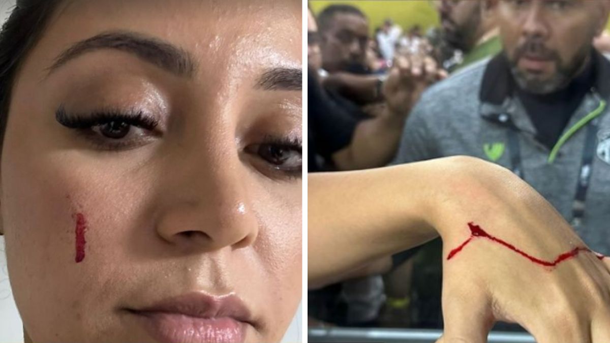 Após quebrar vidro do PV, Nenê paga fiança e é liberado, mas responderá por lesão culposa 2 Machucados nas esposas de Saulo Mineiro e Chrystian Barletta, do Ceará